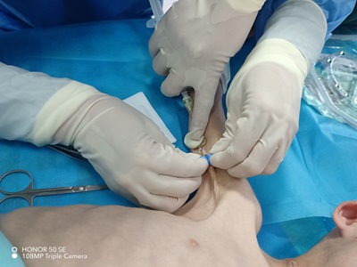 新突破丨六合彩生肖
儿科二病区开展首例PICC原位换管置管术，为危重症患儿打通“生命通道”